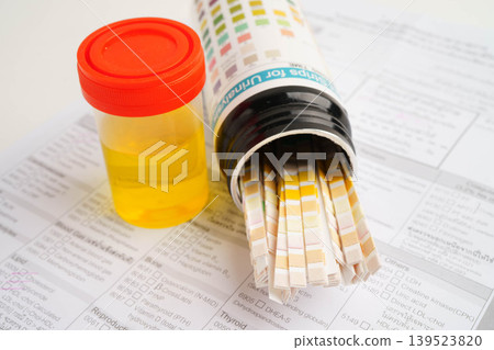 Urinalysis, urine cup with reagent strip pH paper test and comparison chart in laboratory. 139523820