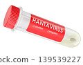 Transparent hantavirus test tube with positive negative options for laboratory diagnosis concept, 3d rendering 139539227
