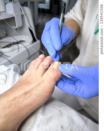 Procedure for Podological Cleaning of a Patient's Toenail Procedure for Podological Cleaning of a Patient's Toenail 139541506