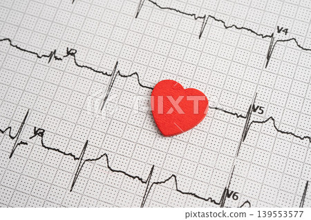 Electrocardiogram ECG, heart wave, heart attack, cardiogram report. Electrocardiogram ECG, heart wave, heart attack, cardiogram report. 139553577