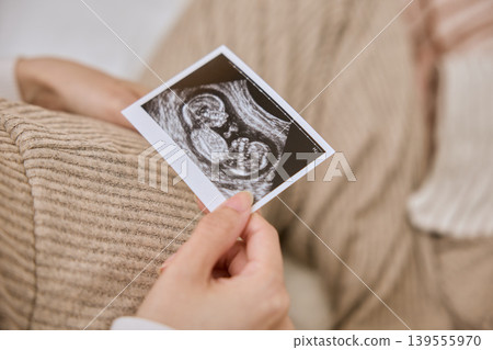 The hands of a pregnant woman gazing at an ultrasound image 139555970