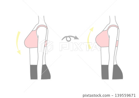 女性隆乳手術前後對比照片 139559671
