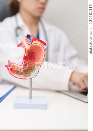 Doctor with Gastric anatomy model. Gastroenterologist consultation, stomach diseases and ulcers, November stomach cancer, Gastroesophageal Reflux Disease, GERD, Acid reflux and healthcare medical Doctor with Gastric anatomy model. Gastroenterologist consultation, stomach diseases and ulcers, November stomach cancer, Gastroesophageal Reflux Disease, GERD, Acid reflux and healthcare medical 139581516