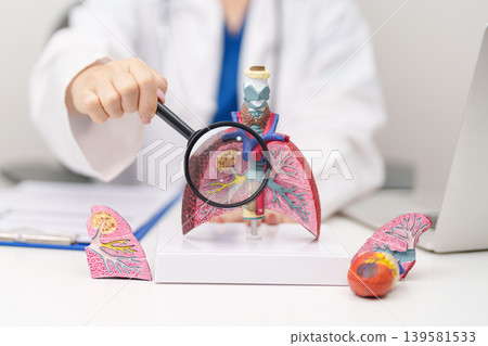Doctor with Smoker Lung anatomy with magnifying glass. Lung Cancer, Asthma, Chronic Obstructive Pulmonary or COPD, Bronchitis, Emphysema, Cystic Fibrosis, Bronchiectasis, Pneumonia and world Lung day 139581533