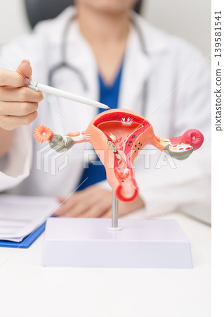 Doctor with Uterus and Ovaries anatomy model. Ovarian and Cervical cancer, Cervix disorder, Endometriosis, Hysterectomy, Uterine fibroids, Reproductive system, Pregnancy and health concept Doctor with Uterus and Ovaries anatomy model. Ovarian and Cervical cancer, Cervix disorder, Endometriosis, Hysterectomy, Uterine fibroids, Reproductive system, Pregnancy and health concept 139581541