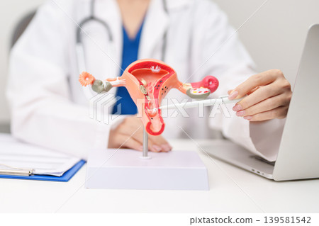 Doctor with Uterus and Ovaries anatomy model. Ovarian and Cervical cancer, Cervix disorder, Endometriosis, Hysterectomy, Uterine fibroids, Reproductive system, Pregnancy and health concept 139581542
