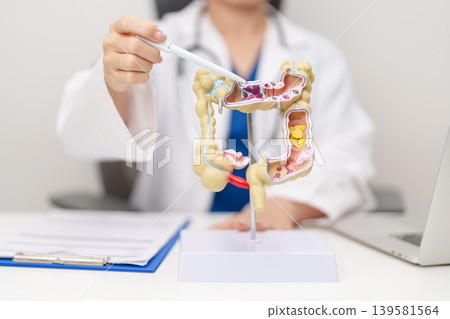 Doctor with human Colon anatomy model. Colonic disease, Large Intestine, Colorectal cancer, Ulcerative colitis, Diverticulitis, Irritable bowel syndrome, Digestive system and Healthcare concept Doctor with human Colon anatomy model. Colonic disease, Large Intestine, Colorectal cancer, Ulcerative colitis, Diverticulitis, Irritable bowel syndrome, Digestive system and Healthcare concept 139581564