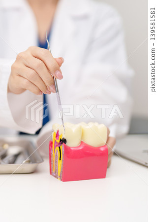 Dentist with tooth Anatomy model. Oral Teeth decay and disease, Scrape off tartar. March Oral health, Dentist Day, False Teeth. Toothache and Children Dental Health Month and Orthodontic Health Day 139581581