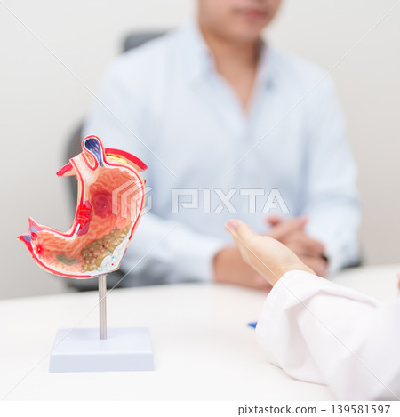 Doctor with Gastric anatomy model. Gastroenterologist consultation, stomach diseases and ulcers, November stomach cancer, Gastroesophageal Reflux Disease, GERD, Acid reflux and healthcare medical Doctor with Gastric anatomy model. Gastroenterologist consultation, stomach diseases and ulcers, November stomach cancer, Gastroesophageal Reflux Disease, GERD, Acid reflux and healthcare medical 139581597