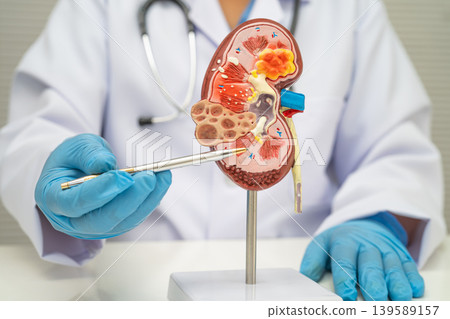 Chronic kidney disease, doctor with model for treatment urinary system, urology, Estimated glomerular filtration rate eGFR. 139589157