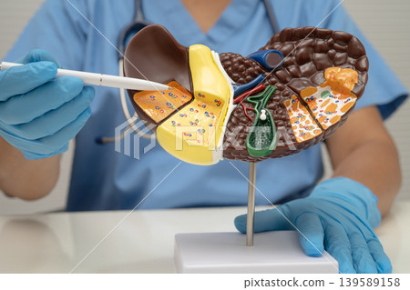 Cirrhosis, Liver cancer, fatty liver, Asian doctor with liver human model. Cirrhosis, Liver cancer, fatty liver, Asian doctor with liver human model. 139589158