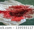 Close up of heavy menstrual blood clot on sanitary pad, feminine hygiene and health concept 139593117