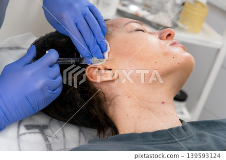 Biorevitalization injections to enhance skin firmness and moisture balance. Biorevitalization injections provide deep moisturizing. Facial biorevitalization to restore hydration and elasticity Biorevitalization injections to enhance skin firmness and moisture balance. Biorevitalization injections provide deep moisturizing. Facial biorevitalization to restore hydration and elasticity 139593124