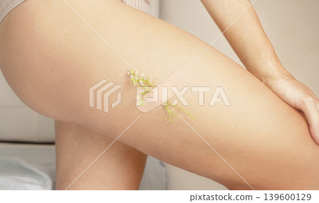 Medical Plaster with flowers on the leg. Leg with a medical patch. Medical Plaster with flowers on the leg. Leg with a medical patch. 139600129