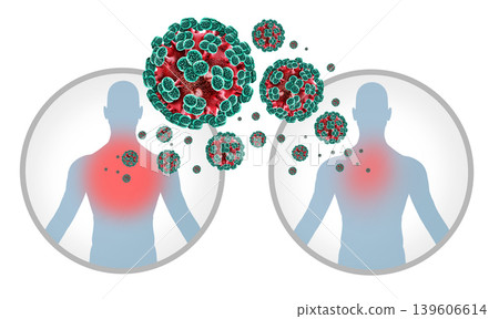 Andes Hantavirus Human Transmission Andes Hantavirus Human Transmission 139606614