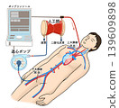 An illustration showing the structure of an ECMO (extracorporeal membrane oxygenation) device. 139609898