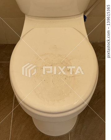 Dirty Toilet Seat Cover With Visible Stain 139615365