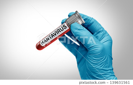 Depression Blood Test 139631561