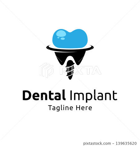 Vector dental implant logo design template Vector dental implant logo design template 139635620
