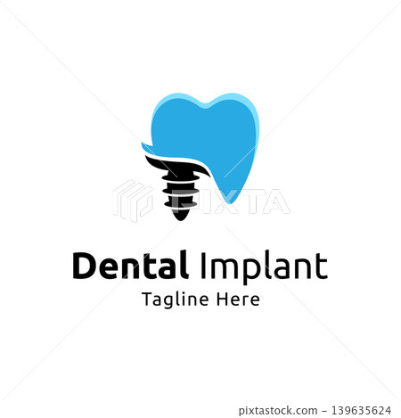 Vector dental implant logo design template Vector dental implant logo design template 139635624