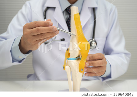 Osteoarthritis of the knee, Doctor holding human knee joint orthopedic anatomy model in hospital. 139640842