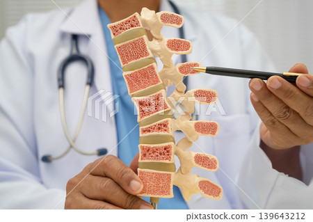 Doctor holding osteoporosis in back bone model for treatment medical in orthopedic department. 139643212