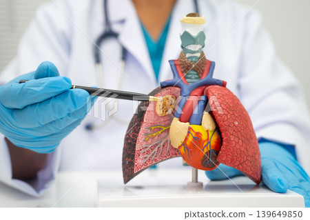 Pneumonia, lung cancer, Asian doctor holding human anatomy model for study diagnosis and treatment in hospital. Pneumonia, lung cancer, Asian doctor holding human anatomy model for study diagnosis and treatment in hospital. 139649850