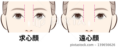 一組比較向心面和離心面的插圖(附指導語)。 一組比較向心面和離心面的插圖(附指導語)。 139656626
