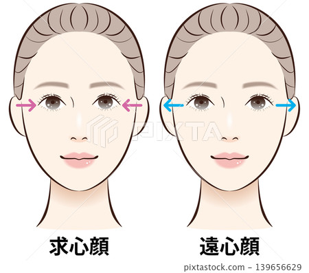 一組比較向心面和離心面的插圖(附解釋性箭頭)。 一組比較向心面和離心面的插圖(附解釋性箭頭)。 139656629