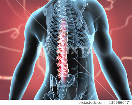 Spinal cord injury concept Spinal cord injury concept 139666647