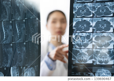 A Japanese female doctor in a white coat looking at X-ray images. 139690467