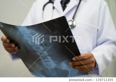 Doctor examining spine bone radiography xray film. Doctor examining spine bone radiography xray film. 139711305