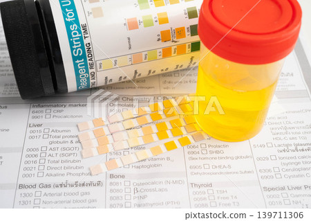 Urinalysis, urine cup with reagent strip pH paper test and comparison chart in laboratory. Urinalysis, urine cup with reagent strip pH paper test and comparison chart in laboratory. 139711306