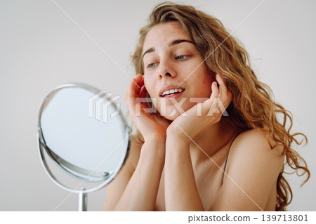curly woman with rashes on her face is worried about the health of her skin. Dermatology concept. curly woman with rashes on her face is worried about the health of her skin. Dermatology concept. 139713801