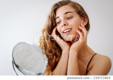 curly woman with rashes on her face is worried about the health of her skin. Dermatology concept. curly woman with rashes on her face is worried about the health of her skin. Dermatology concept. 139713803