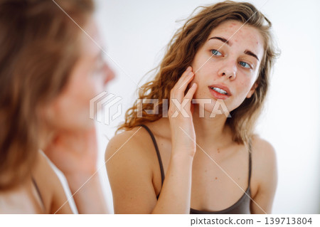 Skin problem. Natural beauty. Medical care and treatment concept. Skin problem. Natural beauty. Medical care and treatment concept. 139713804
