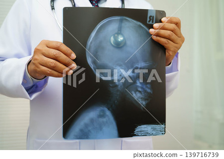 Doctor examining brain radiography xray film. Doctor examining brain radiography xray film. 139716739