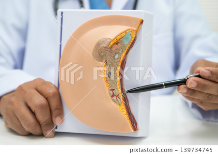 doctor holding female breast human anatomy model. 139734745