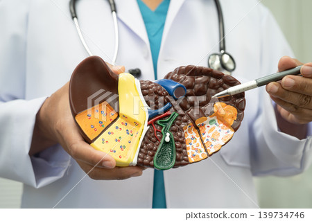Cirrhosis, Liver cancer, fatty liver, Asian doctor with liver human model. Cirrhosis, Liver cancer, fatty liver, Asian doctor with liver human model. 139734746