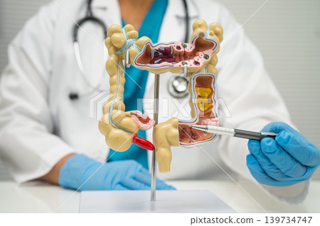 Intestine, doctor holding human anatomy model for study diagnosis and treatment in hospital. 139734747