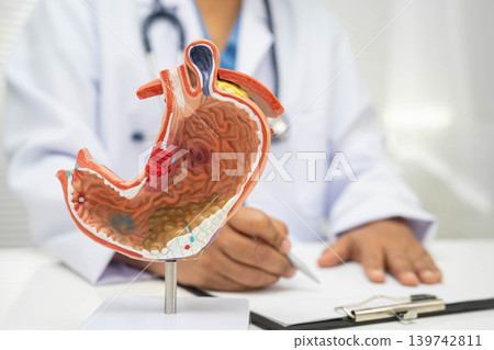 Stomach disease, doctor with anatomy model for study diagnosis and treatment in hospital. Stomach disease, doctor with anatomy model for study diagnosis and treatment in hospital. 139742811