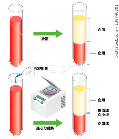 血漿和血清 血漿和血清 139746801