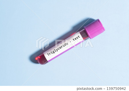 Blood sample tube with triglyceride cholesterol test label on blue background. Blood sample tube with triglyceride cholesterol test label on blue background. 139750942