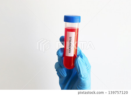 Gloved hand holding blood sample test tube labeled for hantavirus diagnostics. Medical concept for infectious disease detection, laboratory research and healthcare analysis. Gloved hand holding blood sample test tube labeled for hantavirus diagnostics. Medical concept for infectious disease detection, laboratory research and healthcare analysis. 139757120