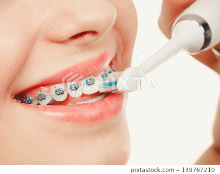 Woman smiling cleaning teeth with braces Woman smiling cleaning teeth with braces 139767210