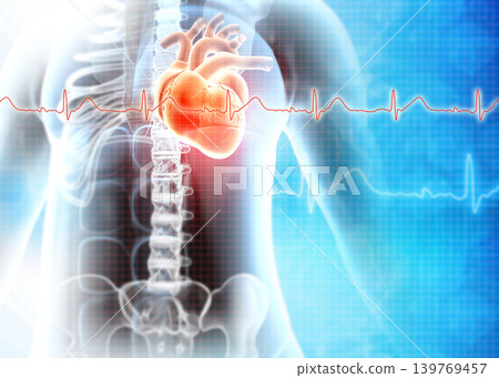 Human heart attack. Heart Disease Human heart attack. Heart Disease 139769457
