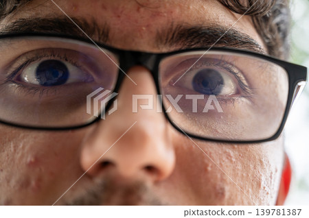 Young man wearing black rimmed glasses and looking directly into the camera, showing a wide eyed gaze and detailed facial features with visible pores and slight acne 139781387