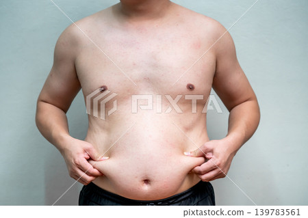 Overweight man pinches abdominal fat with both hands while standing against plain background. Shirtless body highlights excess weight and unhealthy lifestyle concerns. 139783561
