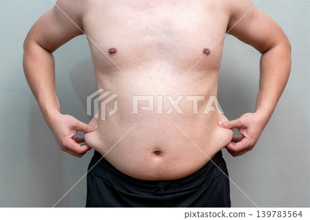 Overweight man pinches abdominal fat with both hands while standing against plain background. Shirtless body highlights excess weight and unhealthy lifestyle concerns. Overweight man pinches abdominal fat with both hands while standing against plain background. Shirtless body highlights excess weight and unhealthy lifestyle concerns. 139783564