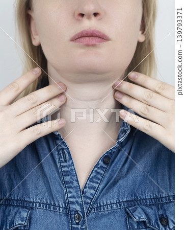 Woman touching sore neck and thyroid gland area, suffering from pain, goiter, throat infection or Venus wrinkles. Medical healthcare and endocrinology concept. Woman touching sore neck and thyroid gland area, suffering from pain, goiter, throat infection or Venus wrinkles. Medical healthcare and endocrinology concept. 139793371